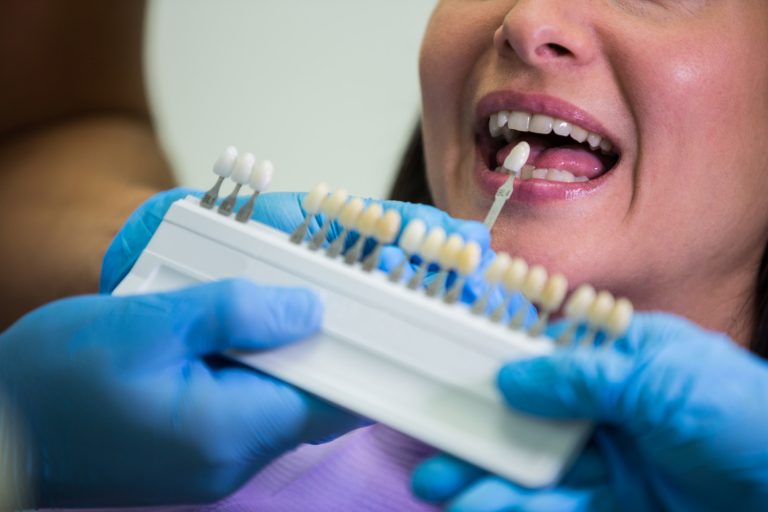 Recupera tu sonrisa con un servicio profesional de implantología dental